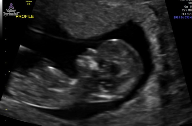 59090f5fc16bb47ec6000003