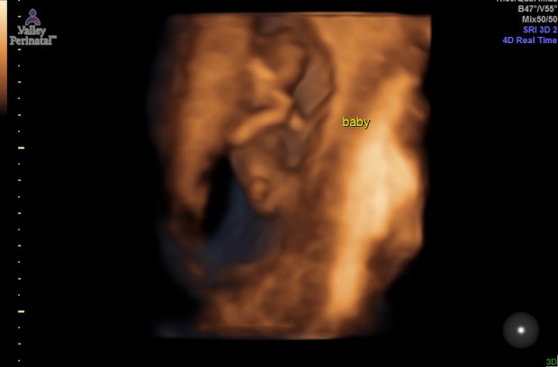 5909145d33c3aff43e000002