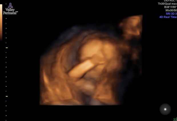 1.2.276.0.26.1.1.1.2.2017.202.84518.4409690.46031872