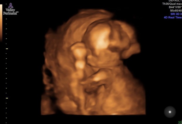 1.2.276.0.26.1.1.1.2.2017.202.84795.4124554.46031872